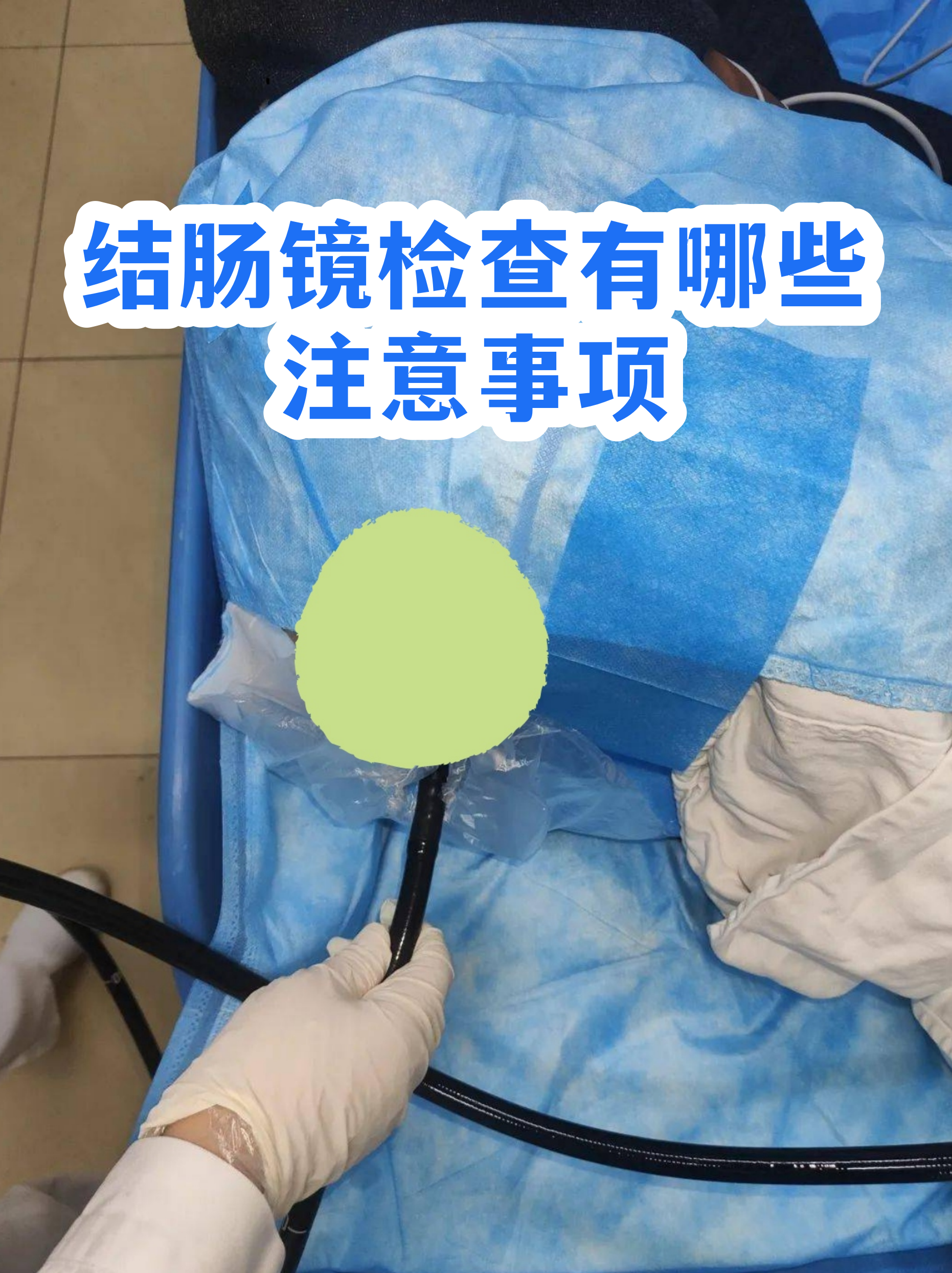 肠镜清肠标准黄水图片(少量粪渣和黄水可以做肠镜吗)