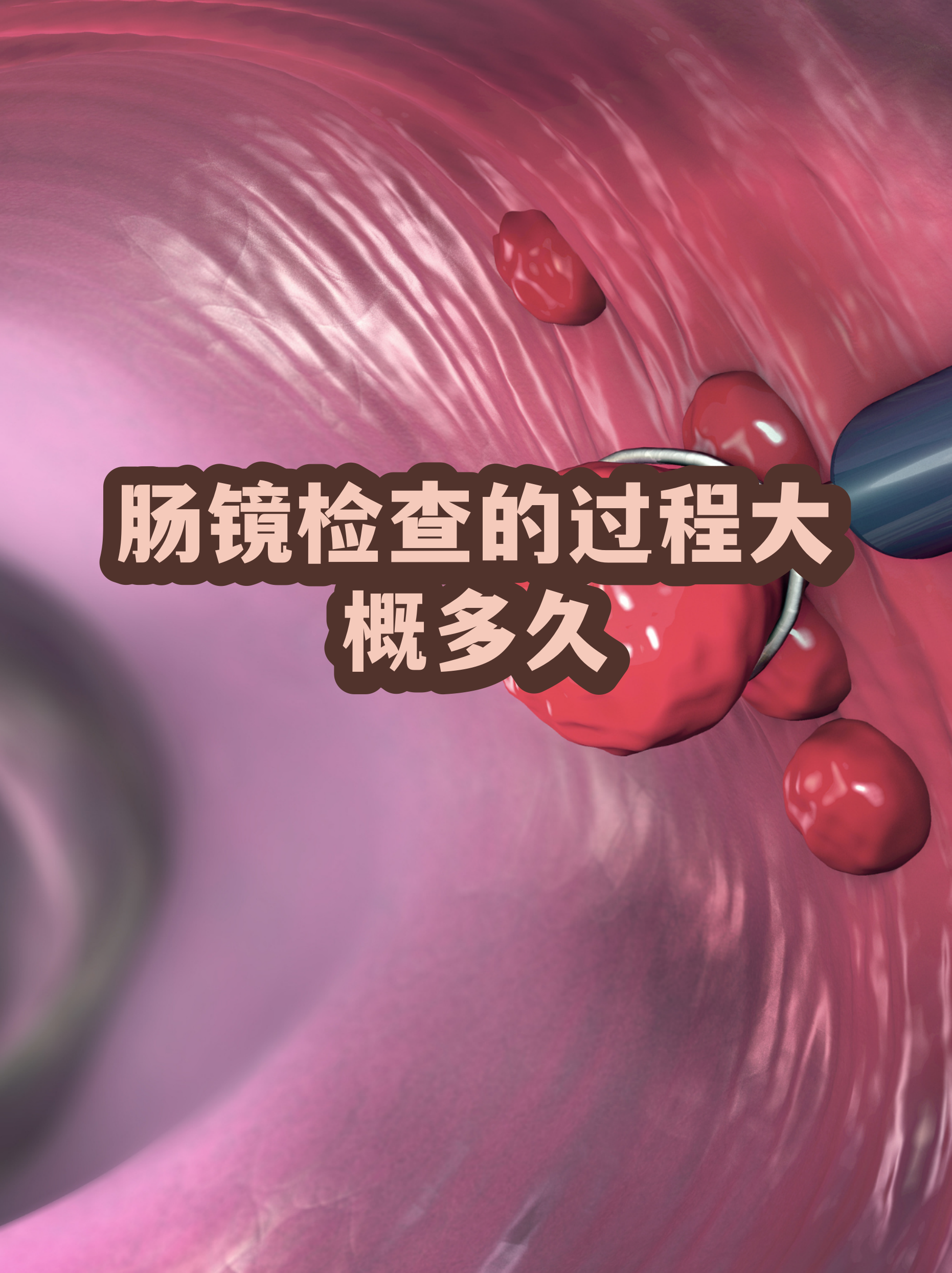 肠镜清肠标准黄水图片(少量粪渣和黄水可以做肠镜吗)