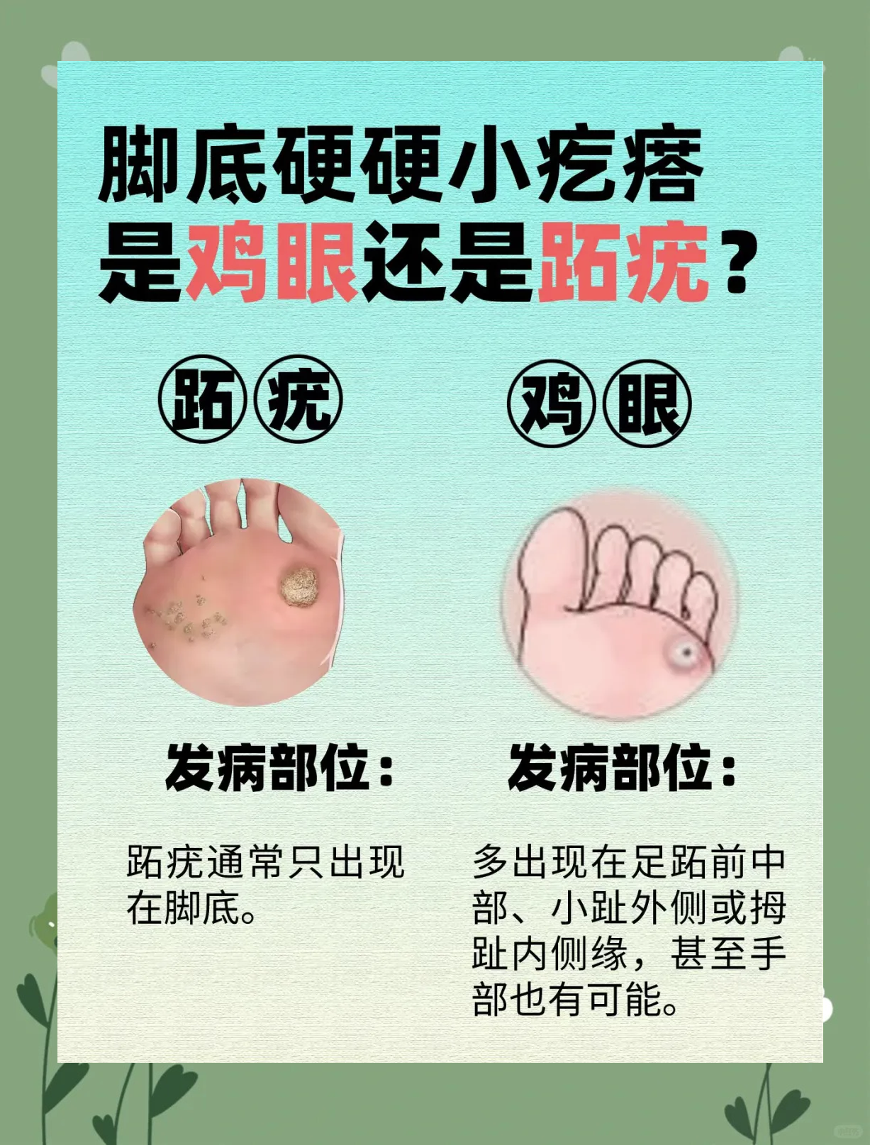 脚疣是什么样子图片(脚疣是什么样子图片和症状)