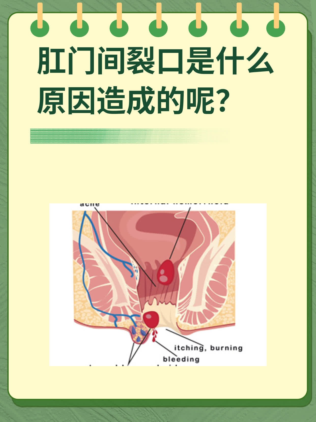 什么是肛裂的症状图片(什么是肛裂 怎么造成的)