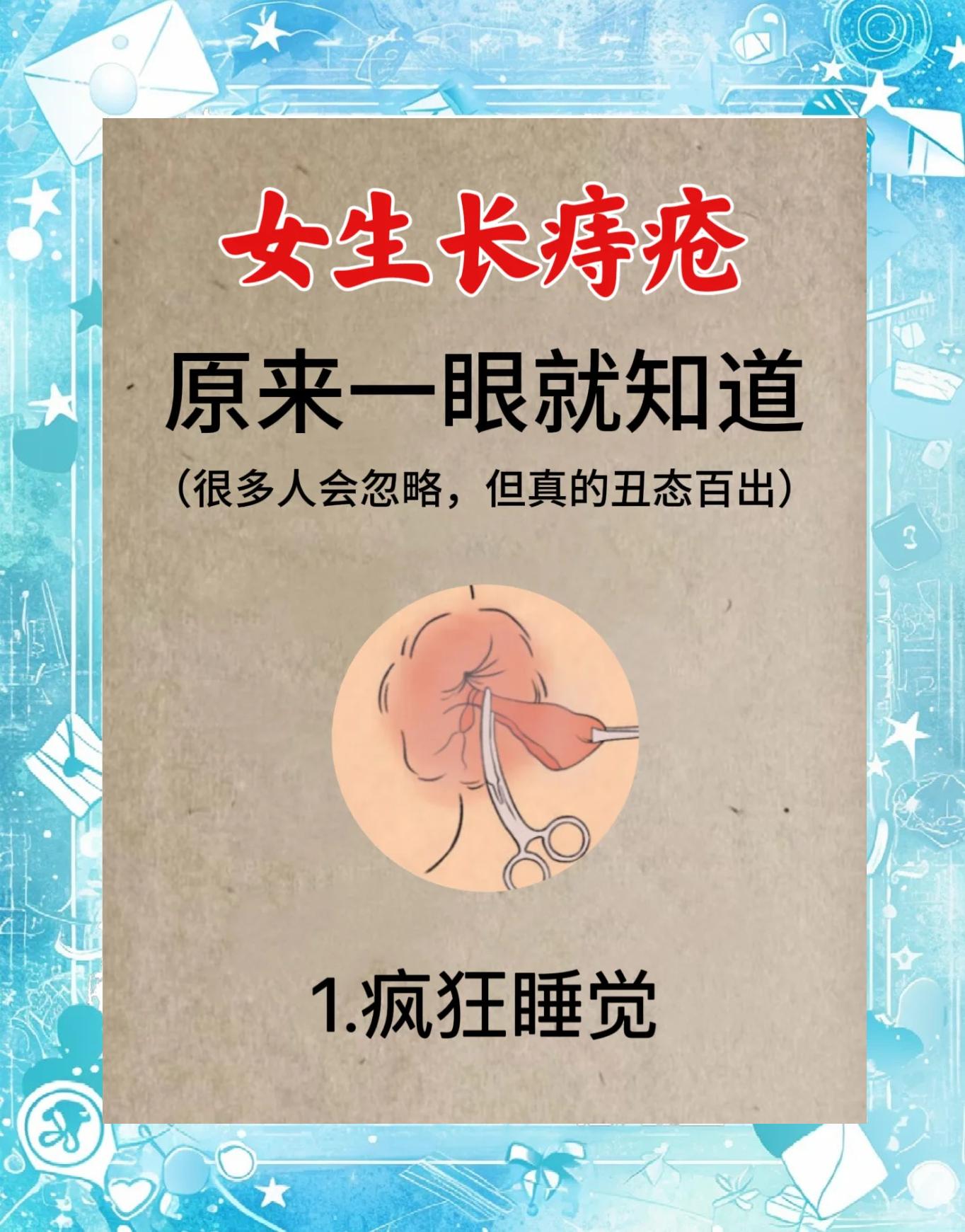 女性外痔图片大全(女性外痔图片 早期图片) 女性外痔图片大全(女性外痔图片 早期图片)
