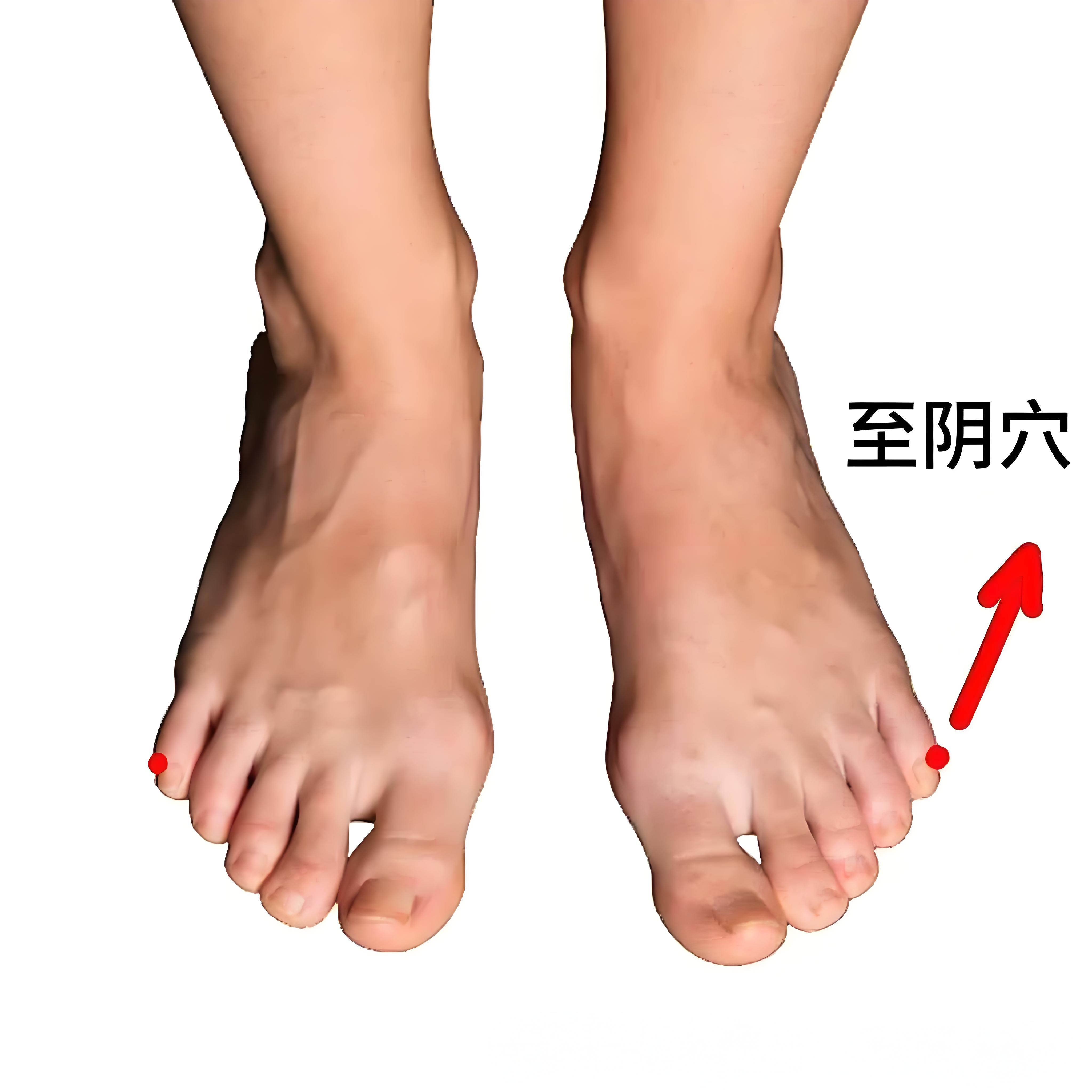 至阴穴(至阴放血好处)