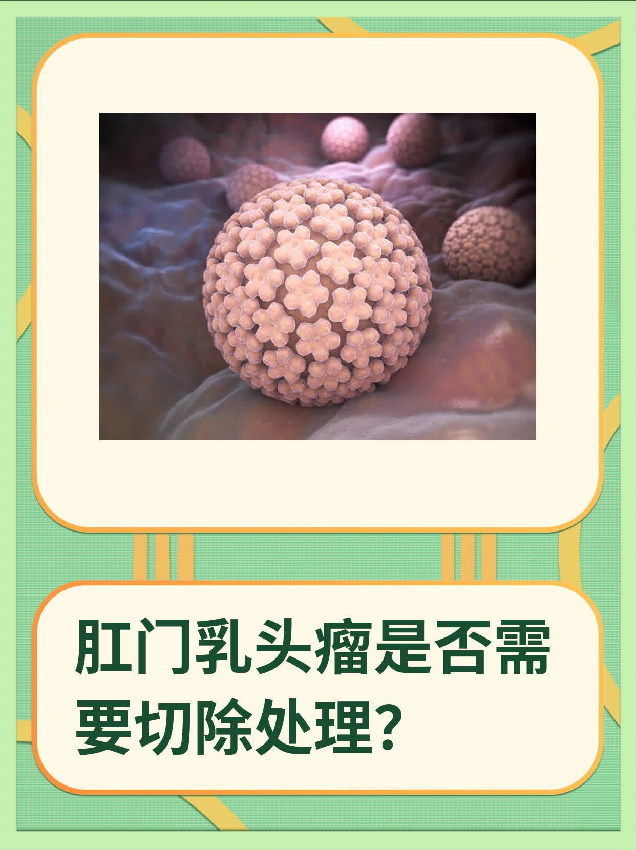 女性肛门癌图片(肛门肿瘤和痔疮的区别)