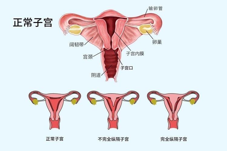 女生子宫图片(正常宫颈图片高清 子宫) 女生子宫图片(正常宫颈图片高清 子宫)