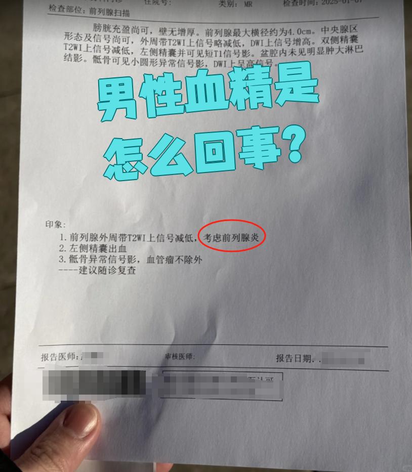 血精图片(血精图片 怎么回事)