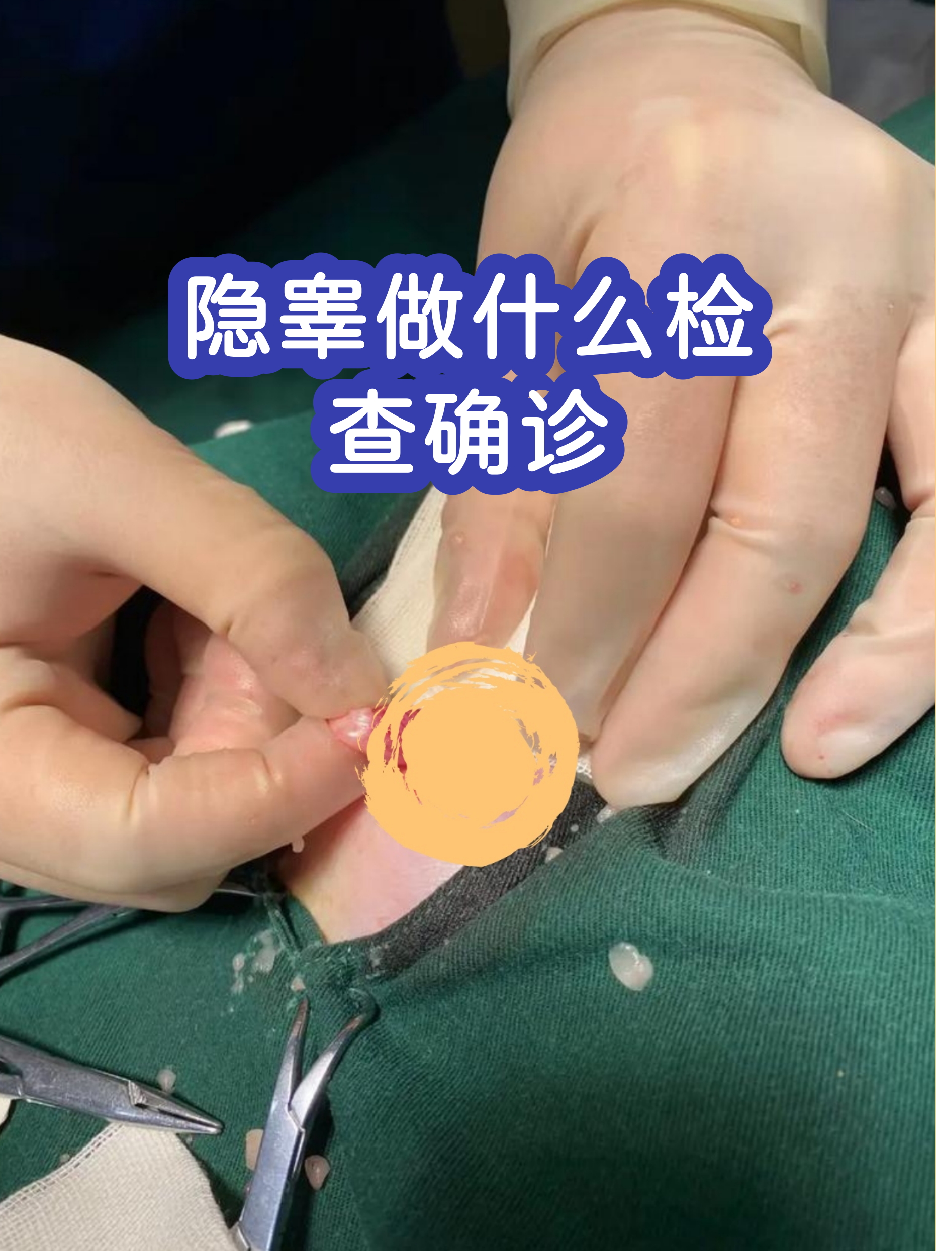 正常的阴囊应该是怎样的图片(正常的阴囊应该是怎样的图片呢)