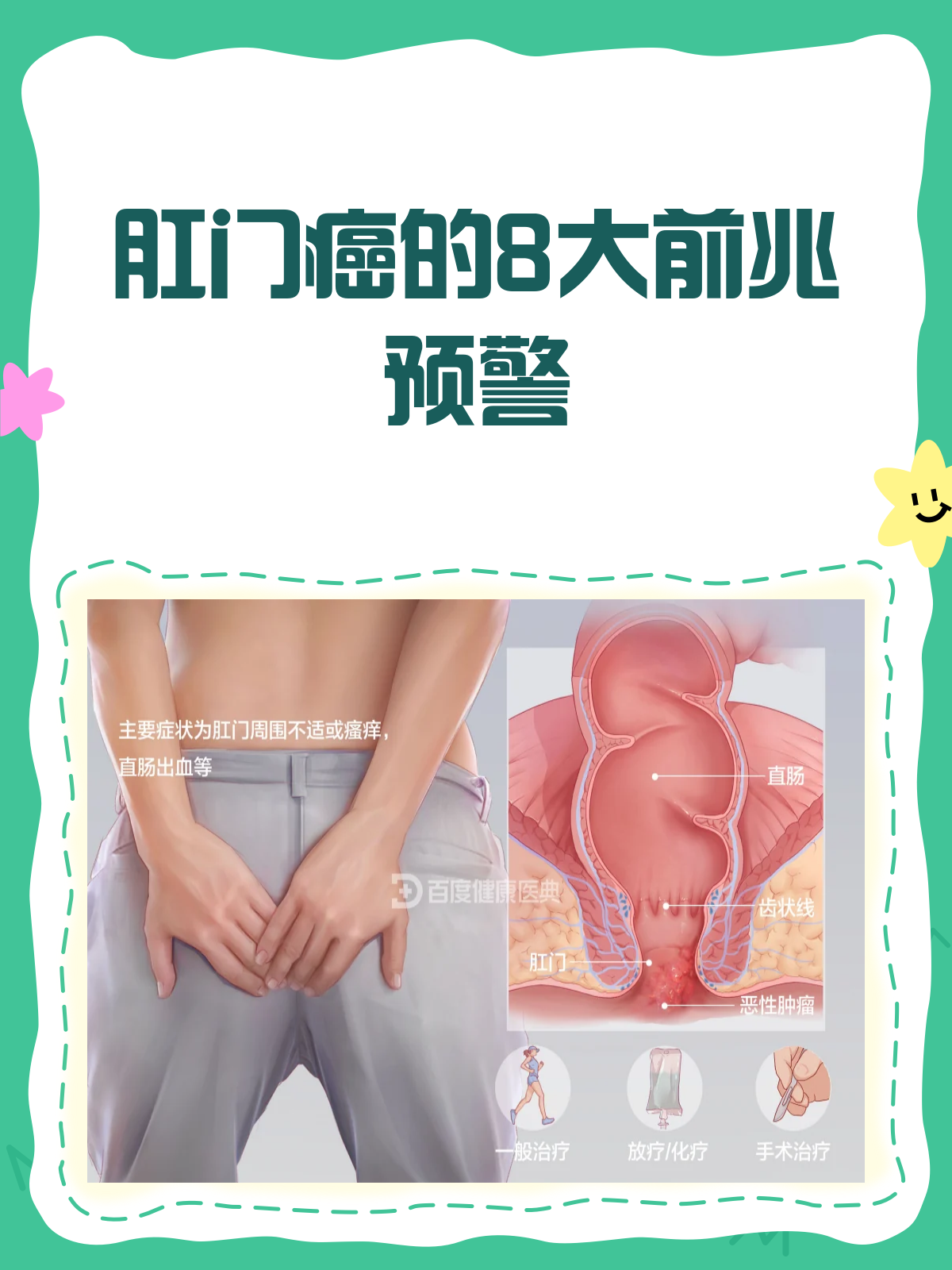 肛门癌是什么症状图片(肛门癌是什么症状图片女性) 肛门癌是什么症状图片(肛门癌是什么症状图片女性)