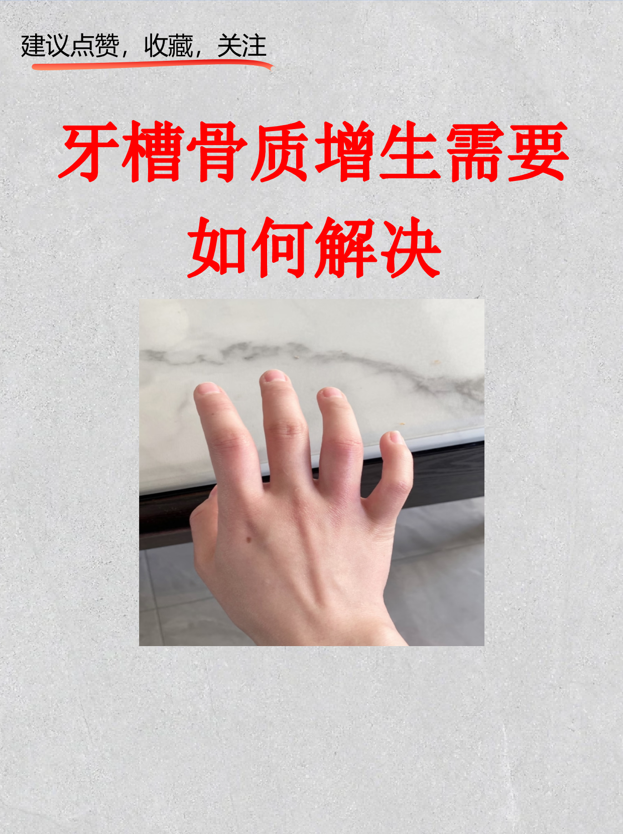 牙槽骨突出图片(牙槽骨突出图片手术)