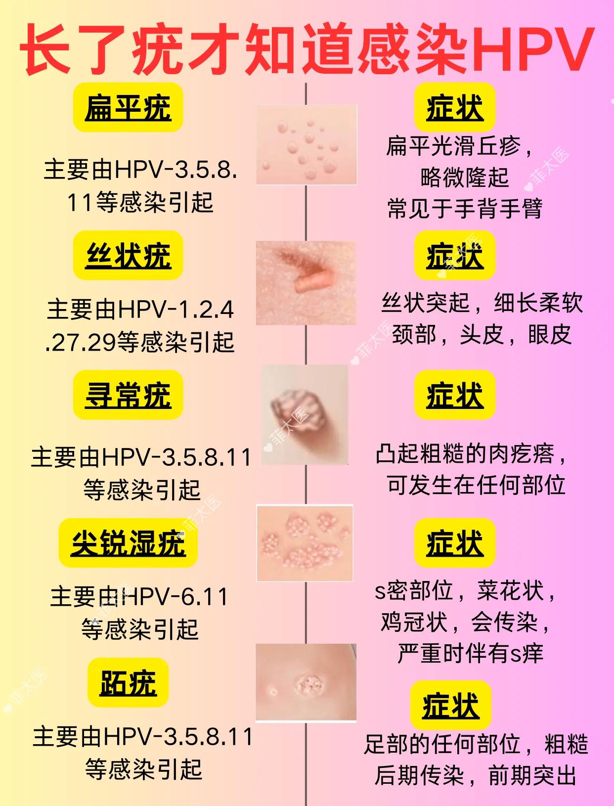 刺猴和疣的区别图片(刺猴和疣的区别图片怎么治疗)