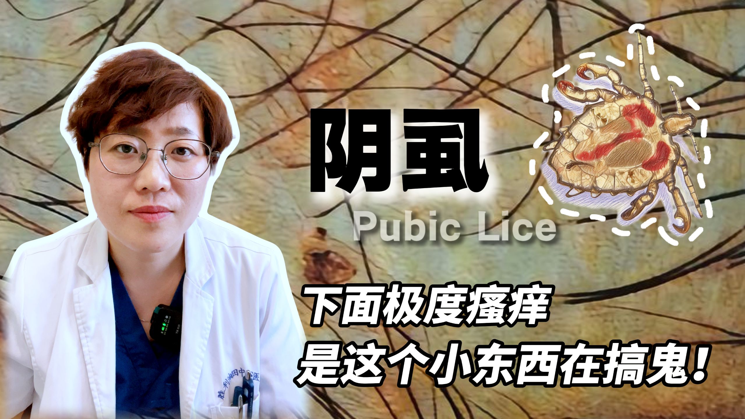 阴虱的图片(阴虱的图片症状图片)