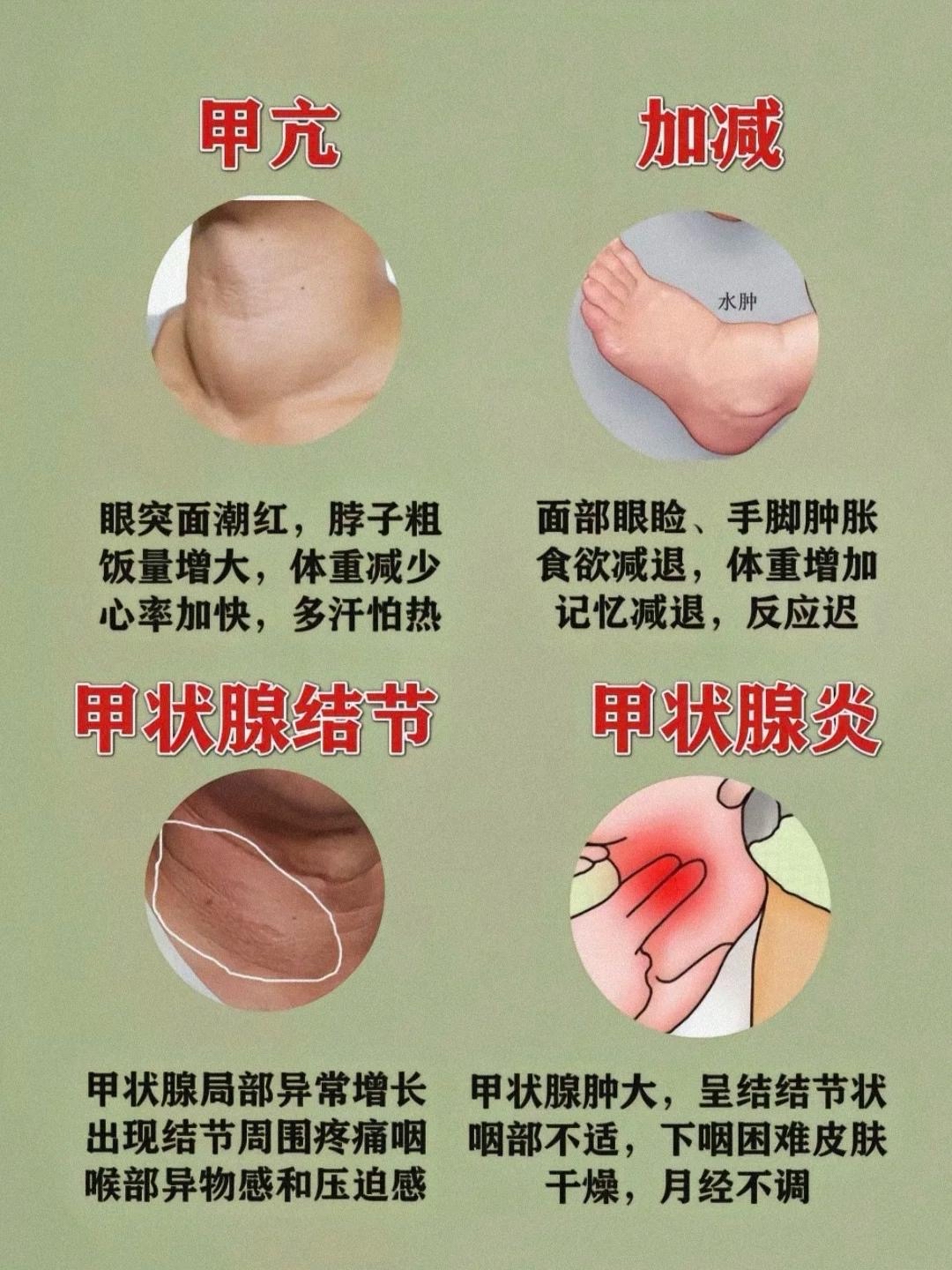 甲减自测脖子(甲减是脖子的哪个位置粗)