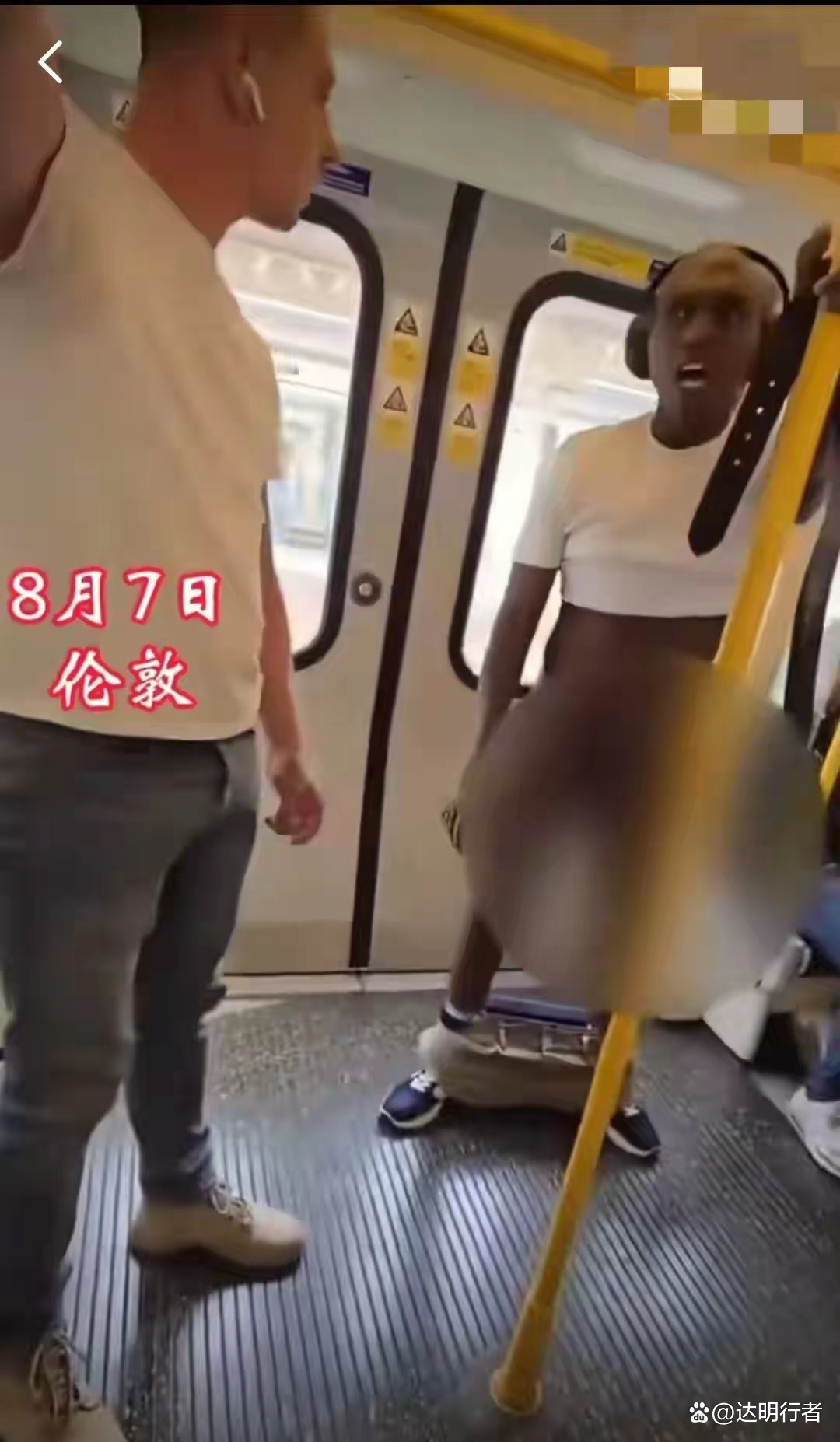下体图片(丝状疣女性下体图片)