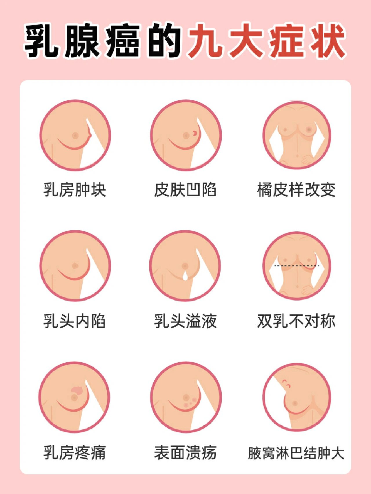 橘皮样乳腺图(橘皮状乳房一定是乳腺癌吗)