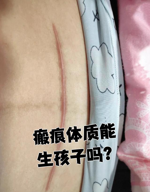 侧切伤口疤痕增生图(伤口愈合后疤痕增生图片)
