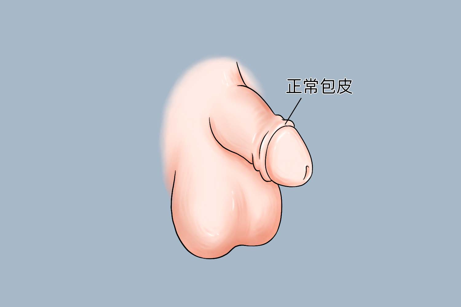 包皮长的图片(包皮图片包皮过长)
