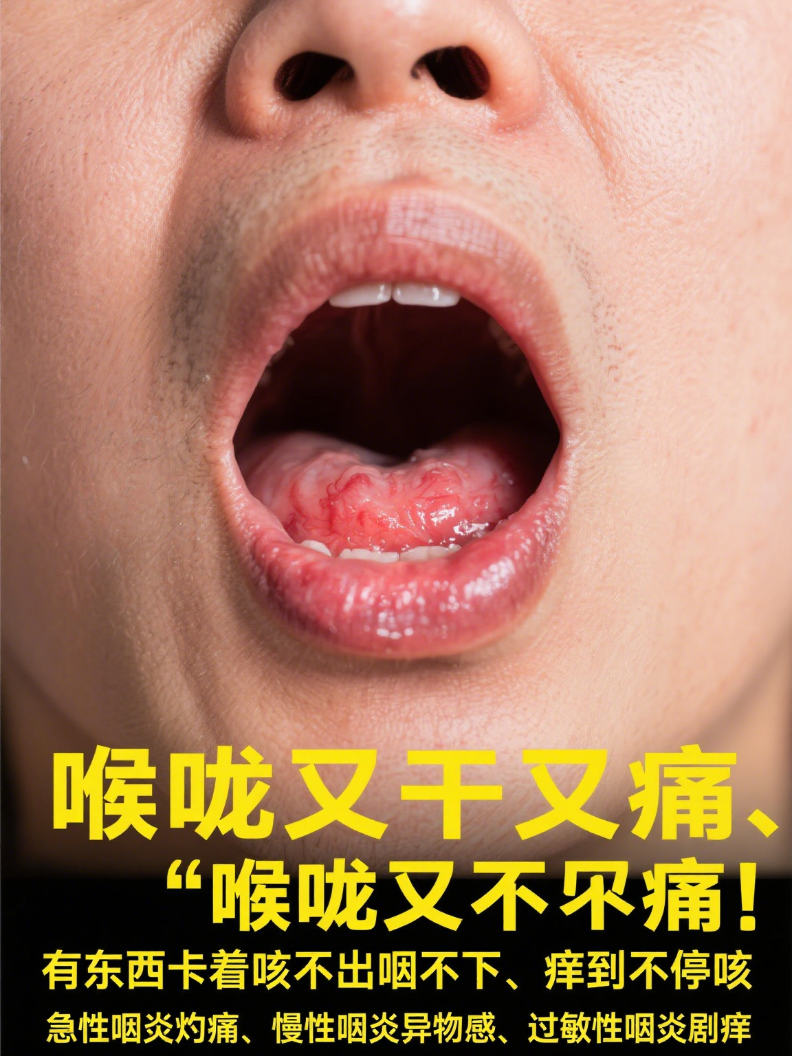 嗓子发炎图片(嗓子发炎图片高清图片)