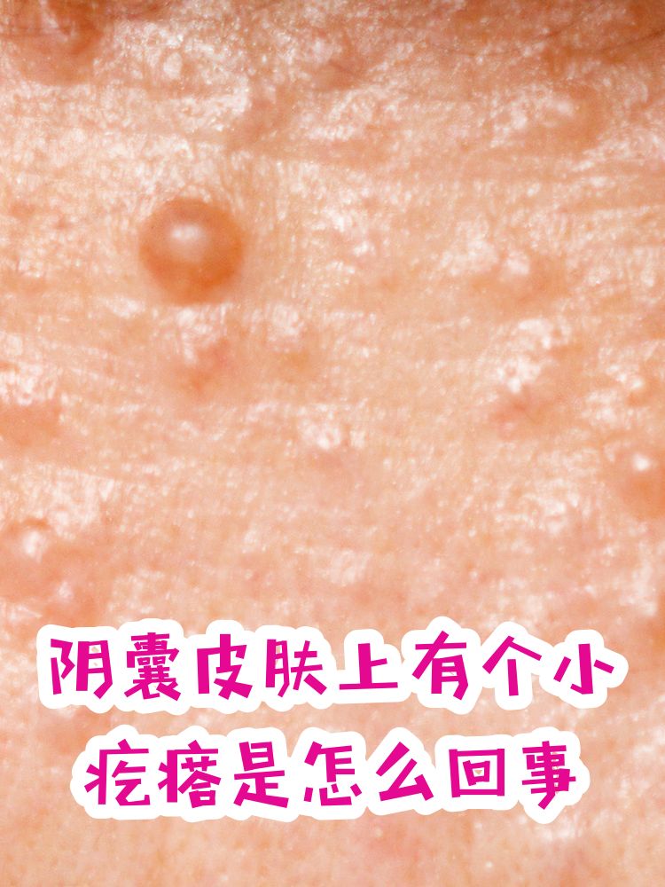 正常的阴囊是什么状态图片(正常的阴囊是什么状态图片女)