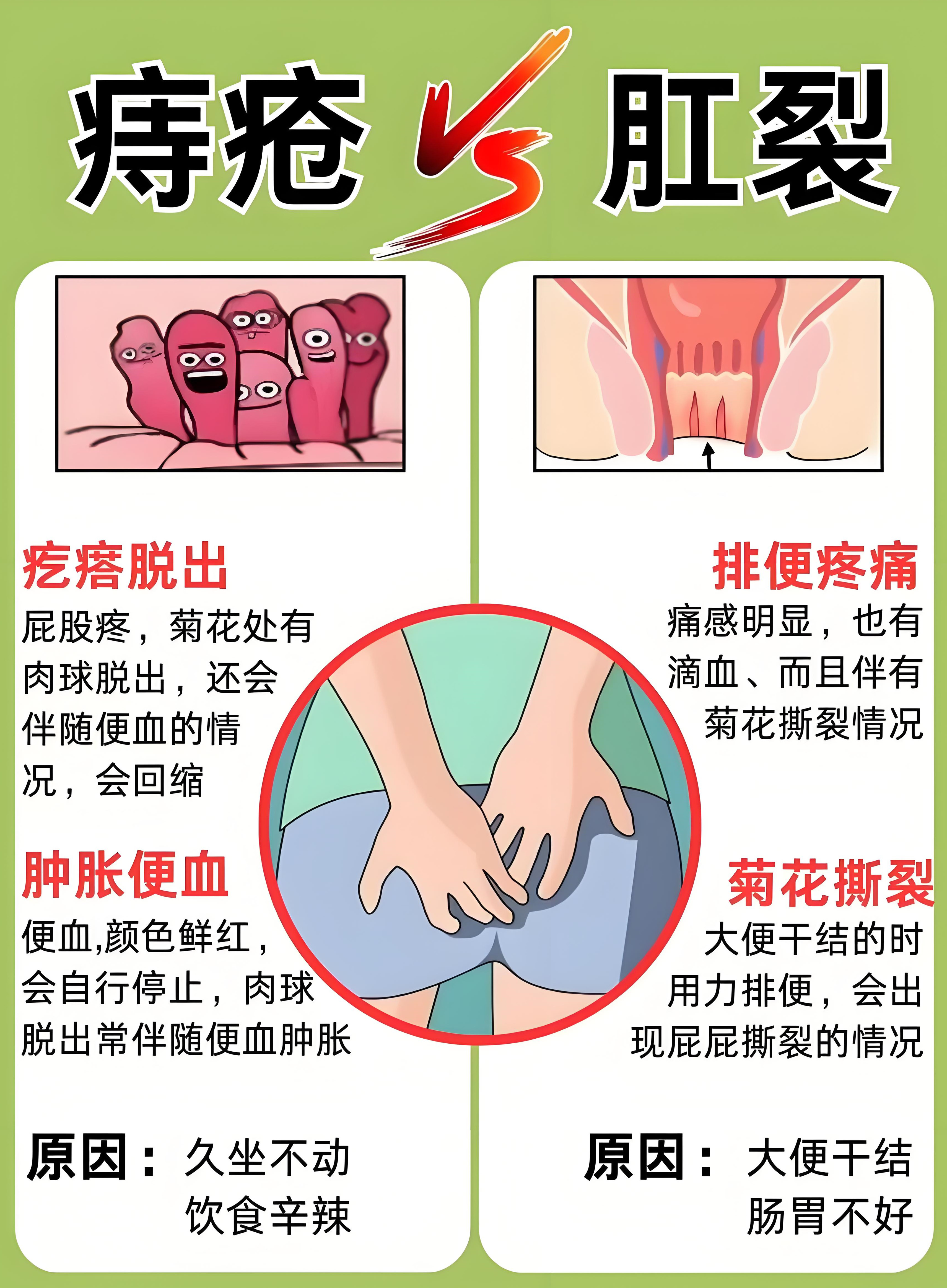 孕妇痔疮图(孕妇痔疮的症状表现有哪些?)
