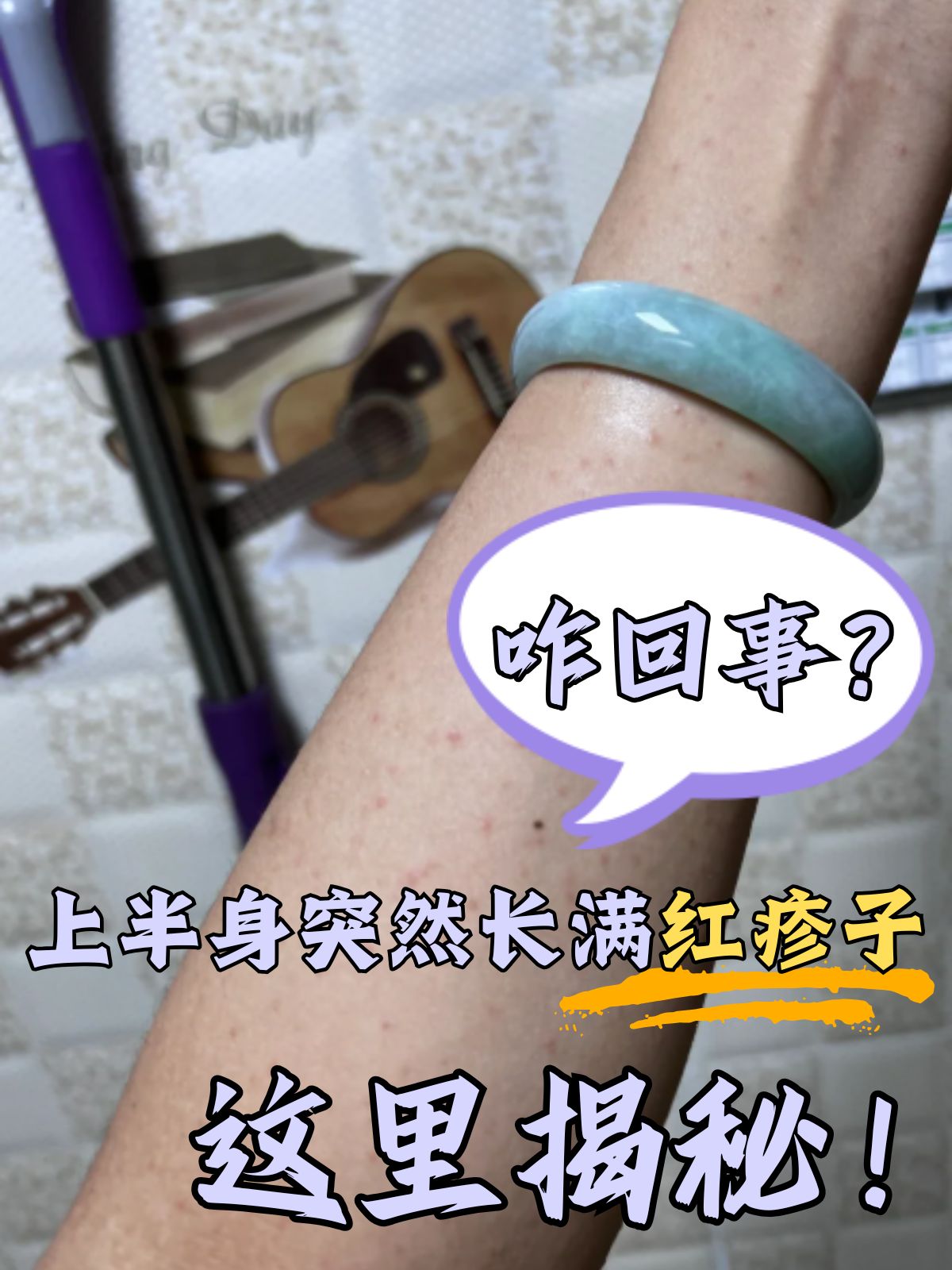 阿莫西林过敏红疹图片(阿莫西林过敏皮疹多久能消退)
