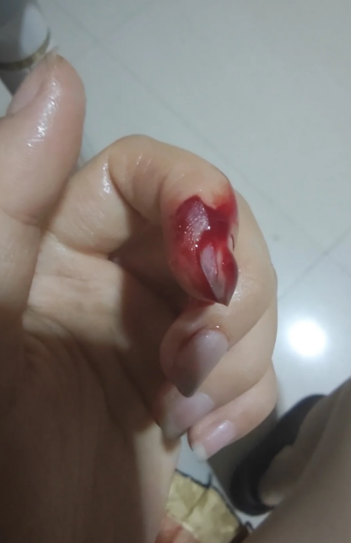 手被刀割伤的图片(手被刀割的图片 流血)