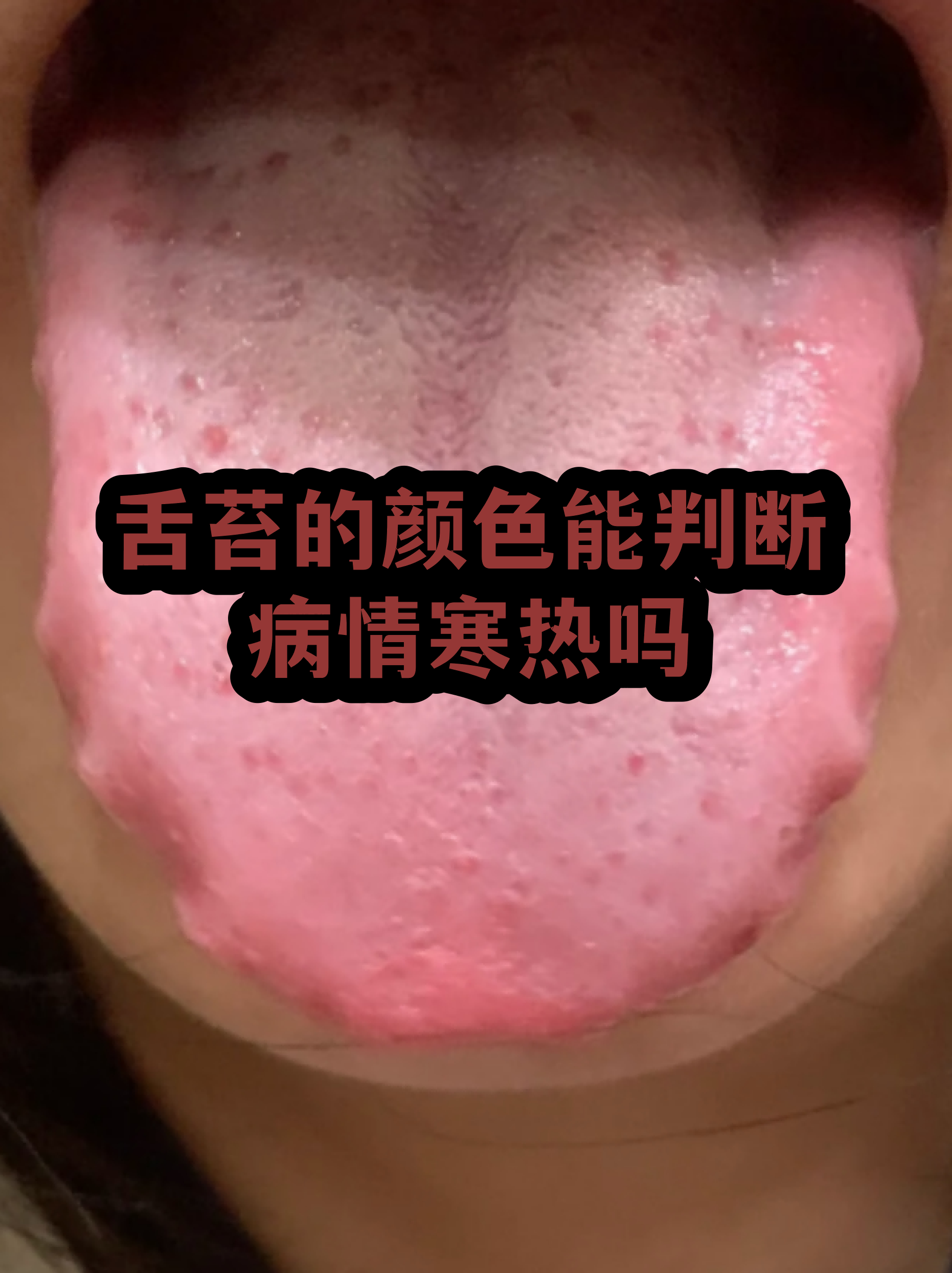 人舌头正常的图片是什么样(人舌头正常的图片是什么样子的)