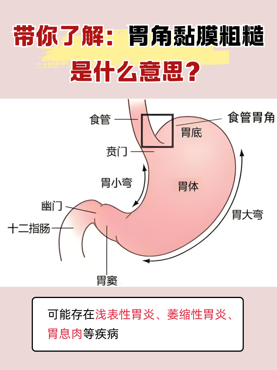 人有几个胃(人有几个胃在什么位置)