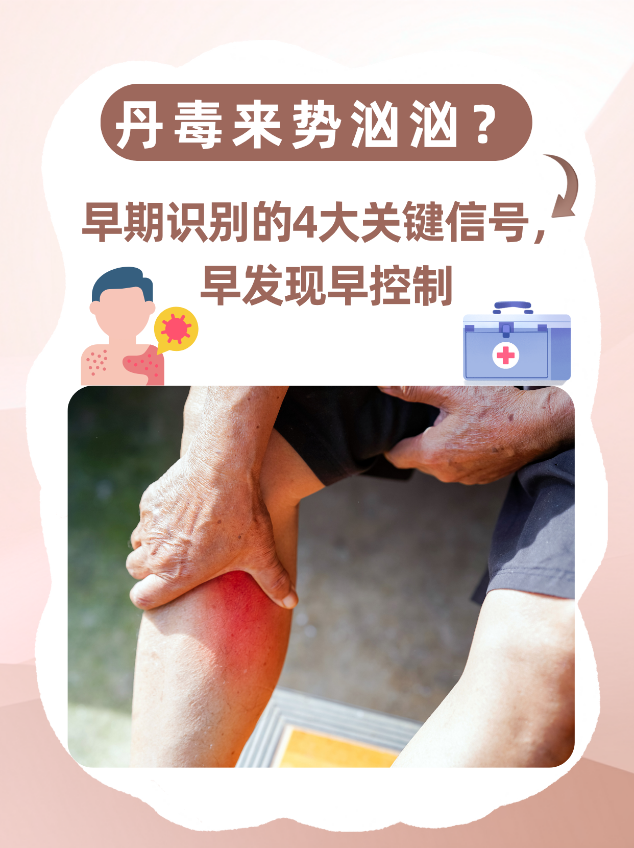 控涎丹的功效与作用(控涎丹的功效与作用及副作用) 控涎丹的功效与作用(控涎丹的功效与作用及副作用)