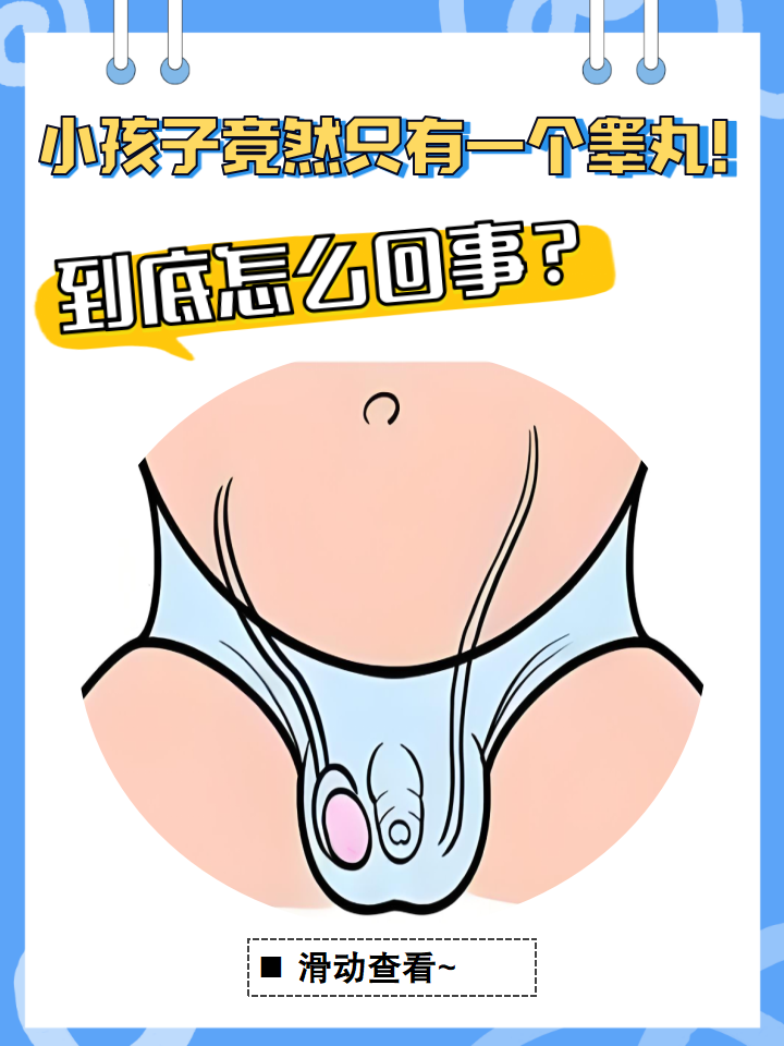 隐睾症的外观真实图片(隐睾症最可能发生的疾病) 隐睾症的外观真实图片(隐睾症最可能发生的疾病)