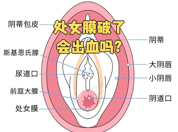 处女膜实物(处女 膜是什么)