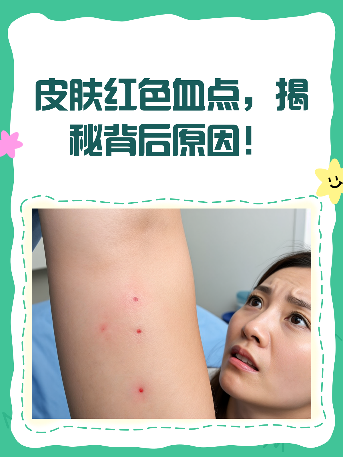 血点图片(白血病出血点图片)
