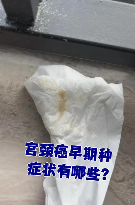宫颈癌图片早期(宫颈癌图片是什么样)