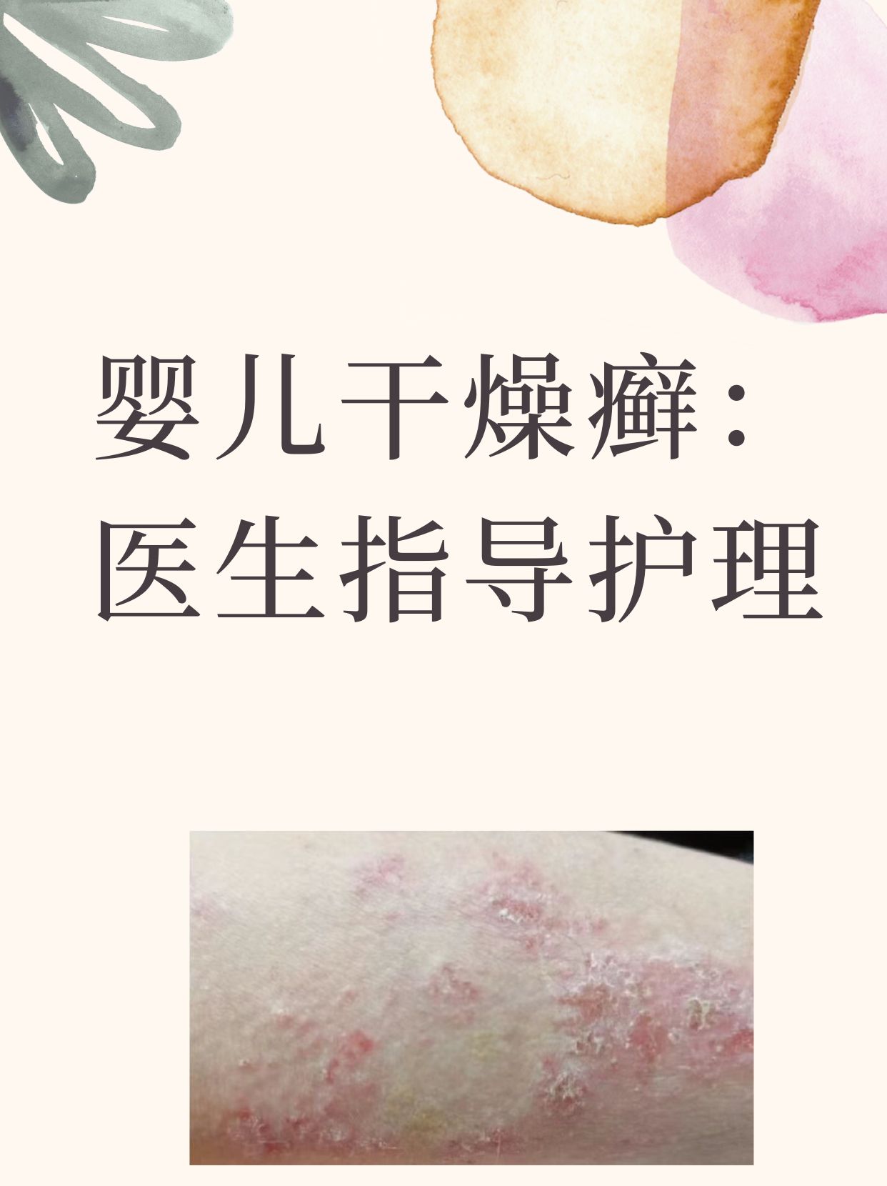 婴儿身上长干燥癣图片(婴儿身上长干燥癣图片和症状)