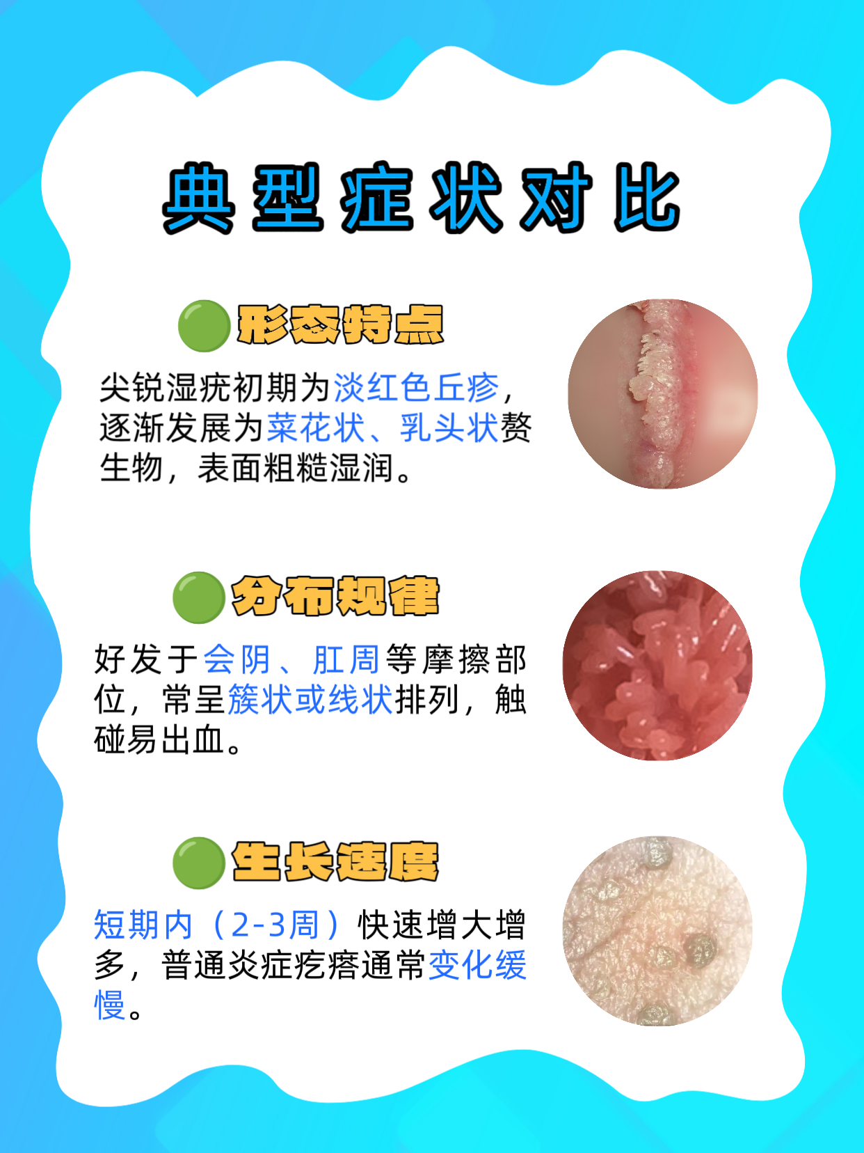假性湿庞早期图片区别(假性湿庞会发展成真的吗)