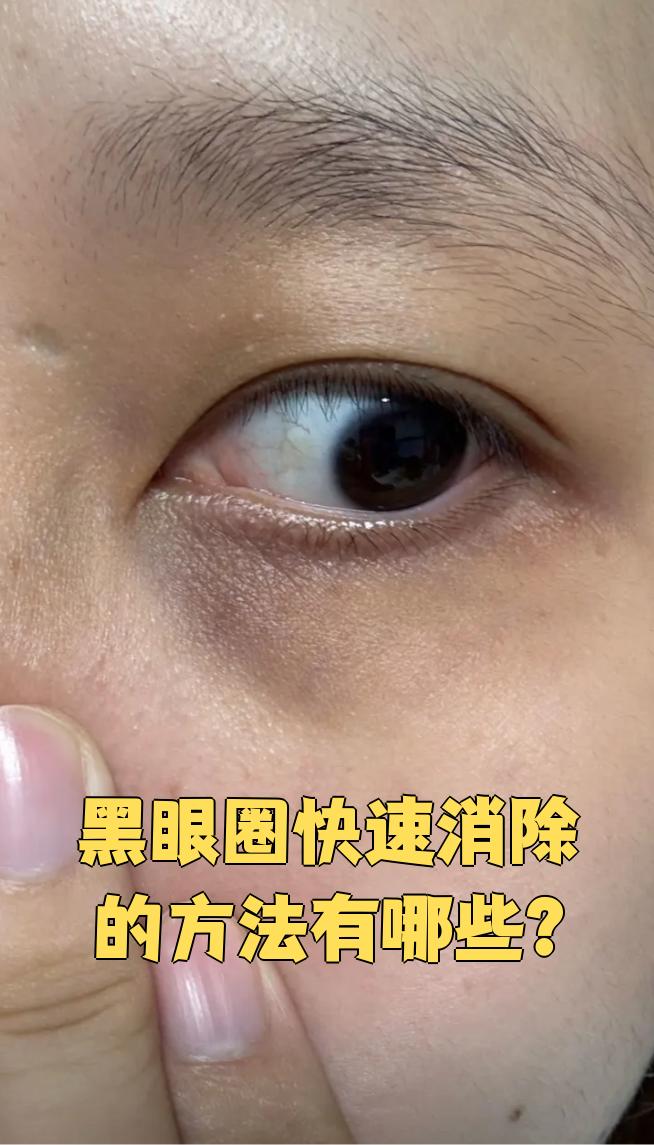 熬夜图片黑眼圈(熬夜图片黑眼圈大全)