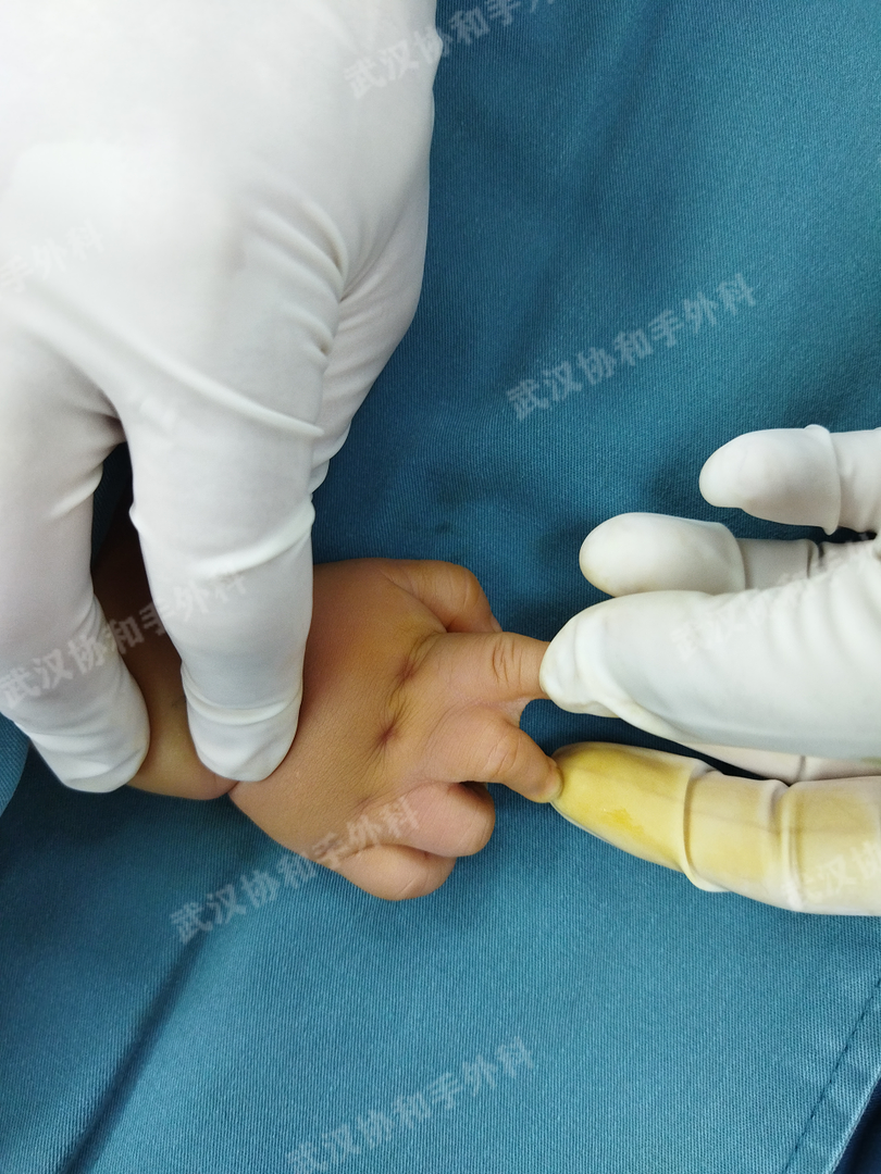 拔毒膏使用过程图片(拔毒膏使用过程图片真实)