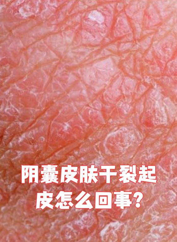 阴囊潮湿的图片(阴囊潮湿图片和症状图片)