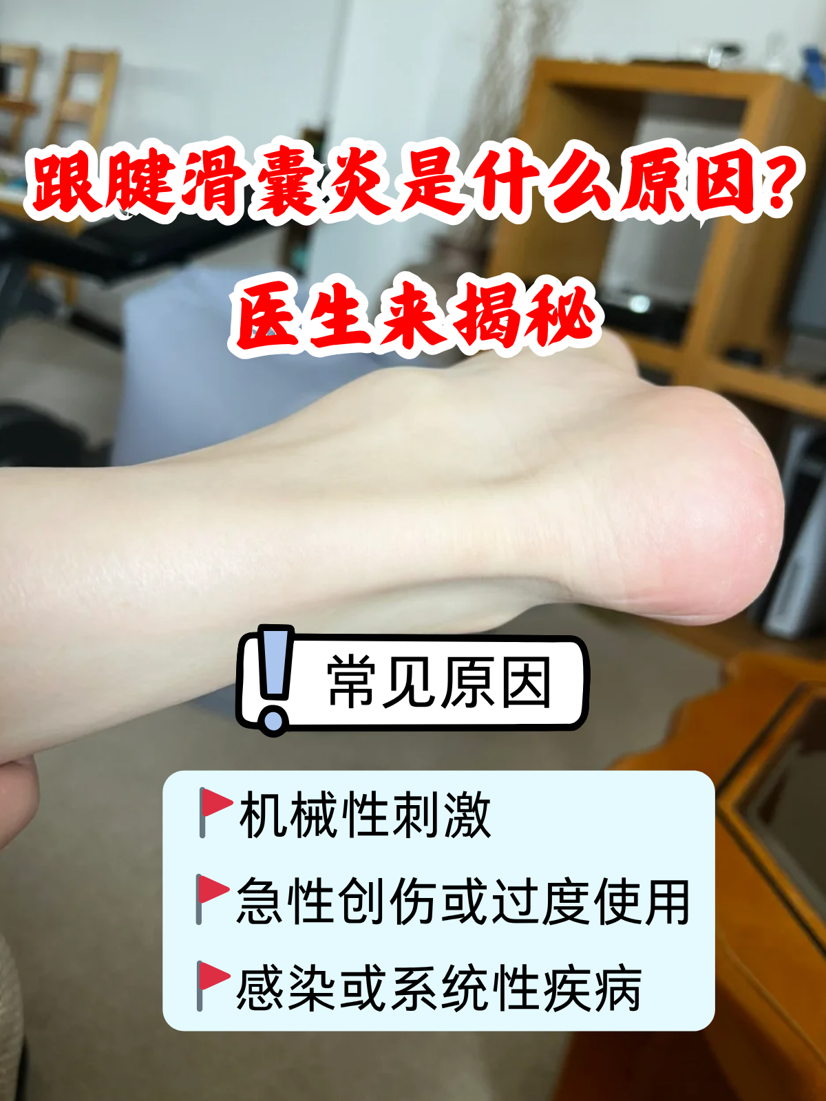 滑囊炎的症状图片(滑囊炎的症状图片女性)