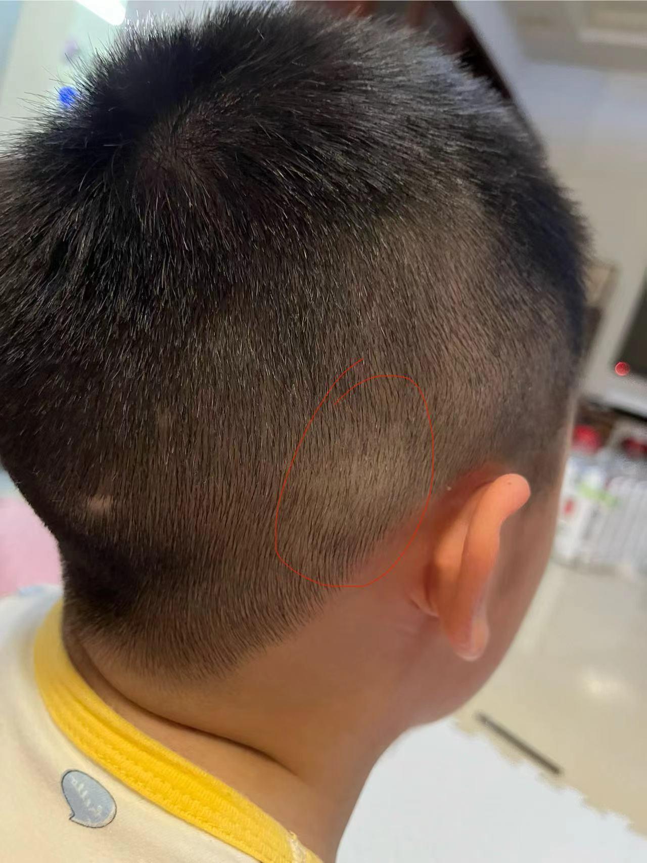 耳朵后面骨头凸起图片(耳朵后面骨头凸起图片用什么药)