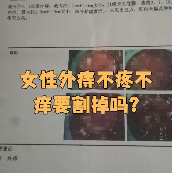 女人痔疮图片实拍(女性痔疮的图片大全)