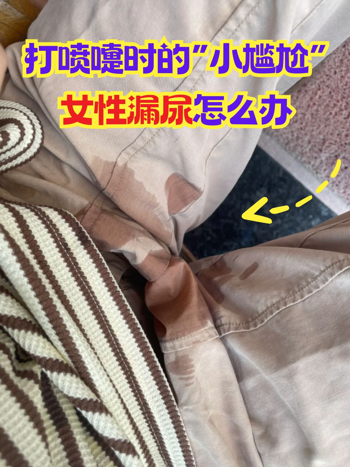 慢性漏羊水的症状图片(慢性漏羊水的症状图片大全) 慢性漏羊水的症状图片(慢性漏羊水的症状图片大全)