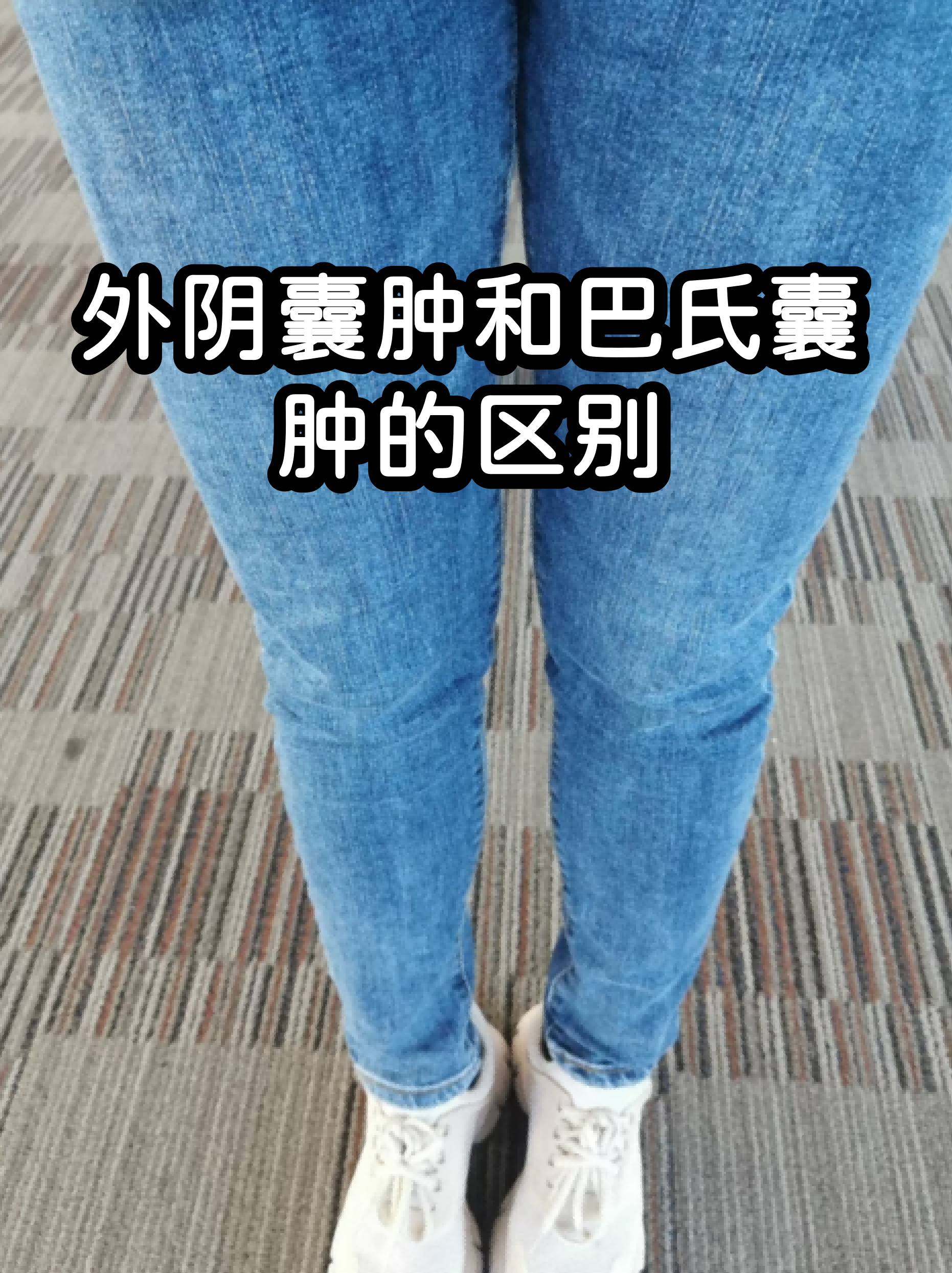 女生的隐私部位长什么样的简单介绍 女生的隐私部位长什么样的简单介绍