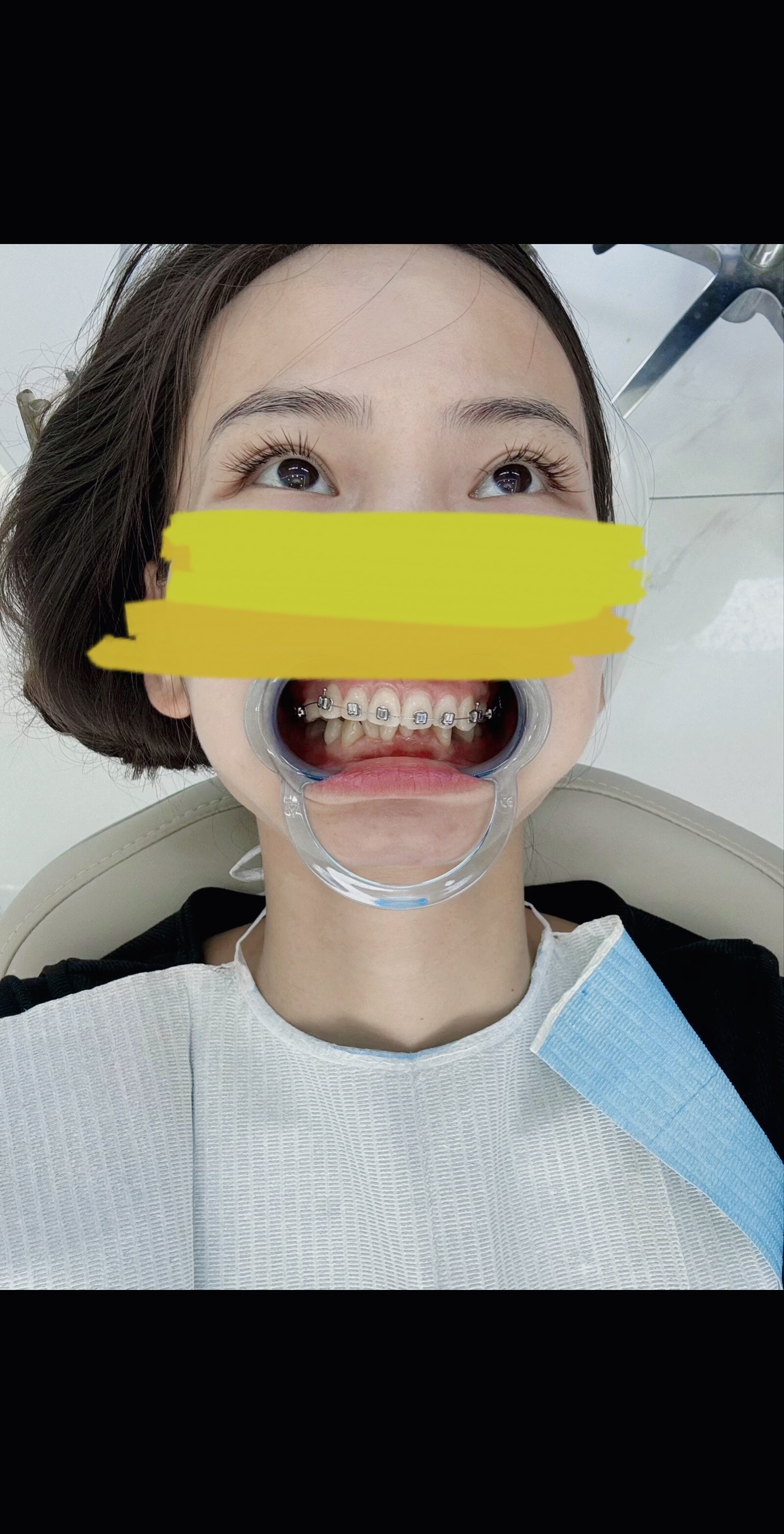 梦见掉了三颗牙齿是什么意思(梦见掉了三颗牙齿是什么意思 女人)