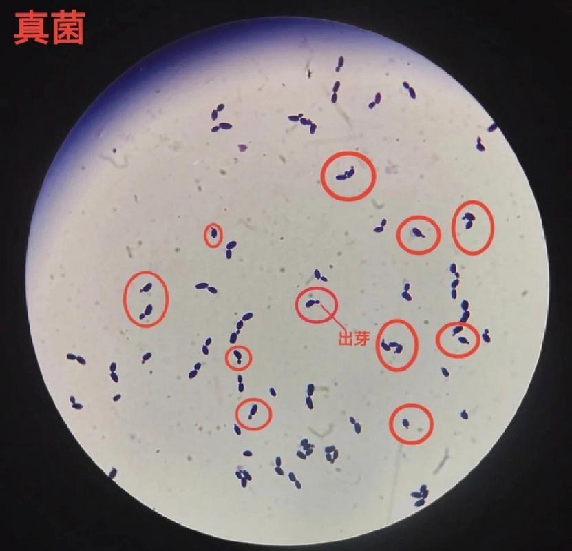 细菌和真菌图片大全(细菌与真菌的区别八年级生物图示)