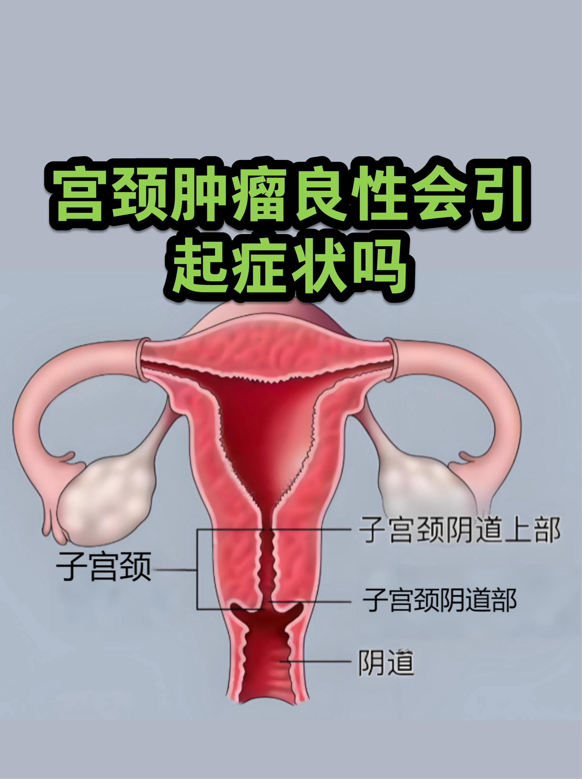 宫颈图(子宫宫颈图)