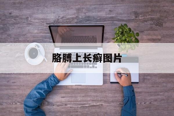 胳膊上长癣图片(胳膊上长癣图片胳膊肘上长小疙瘩)